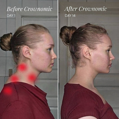 Crownomic™ Neck and Shoulder Massager